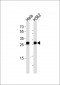 EEF1B2 Antibody (Center)